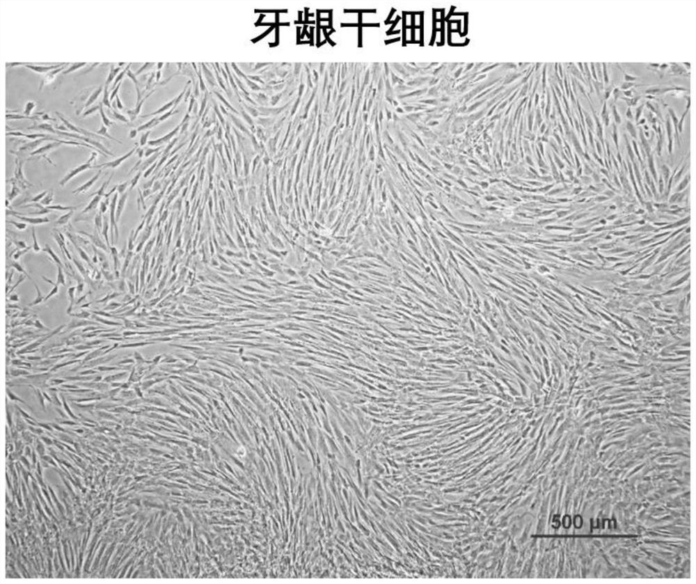 Separation and culture method of gingival stem cells and application of gingival stem cells