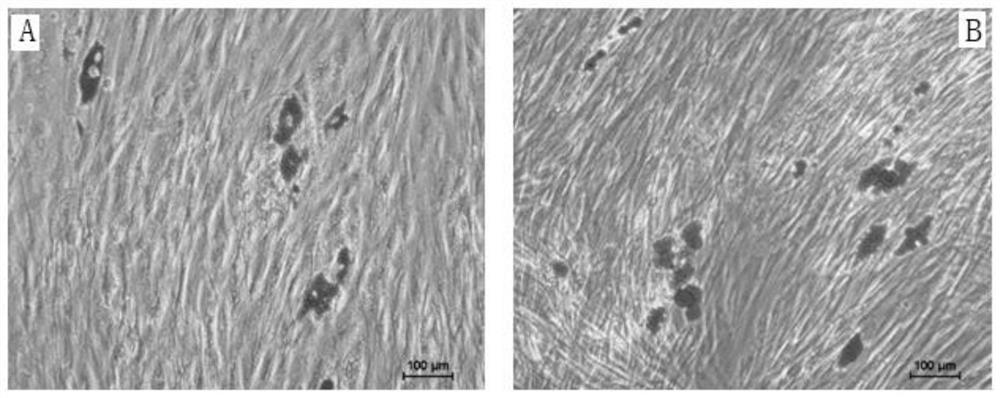 Separation and culture method of gingival stem cells and application of gingival stem cells