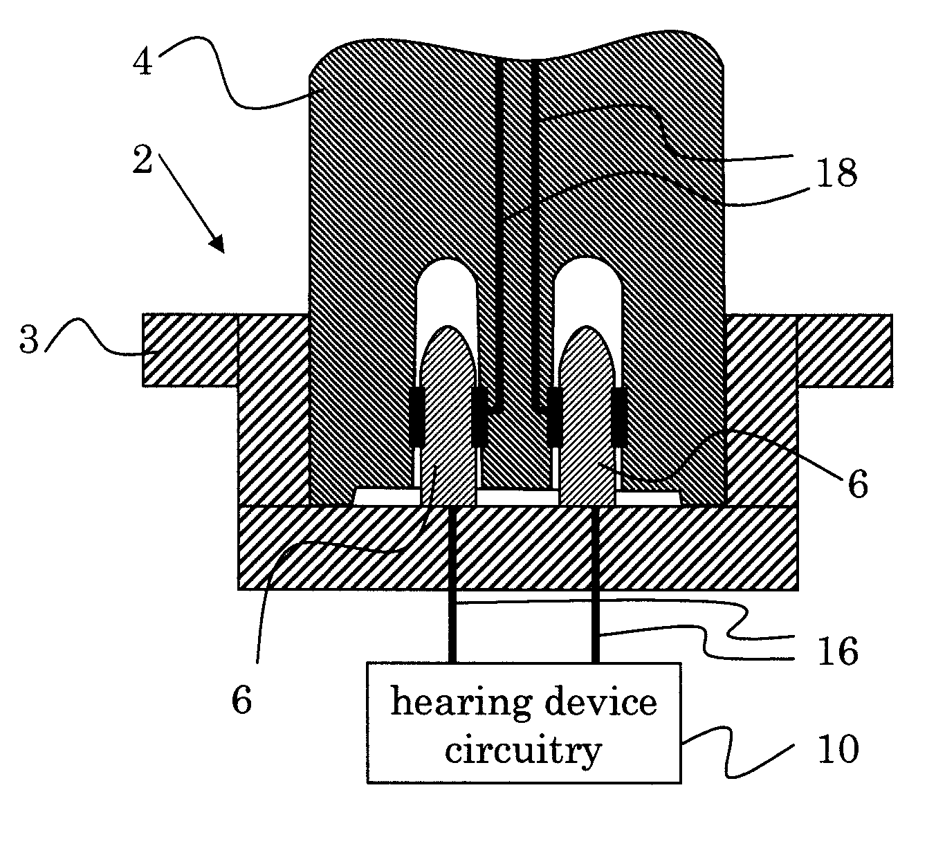 Hearing device with user control