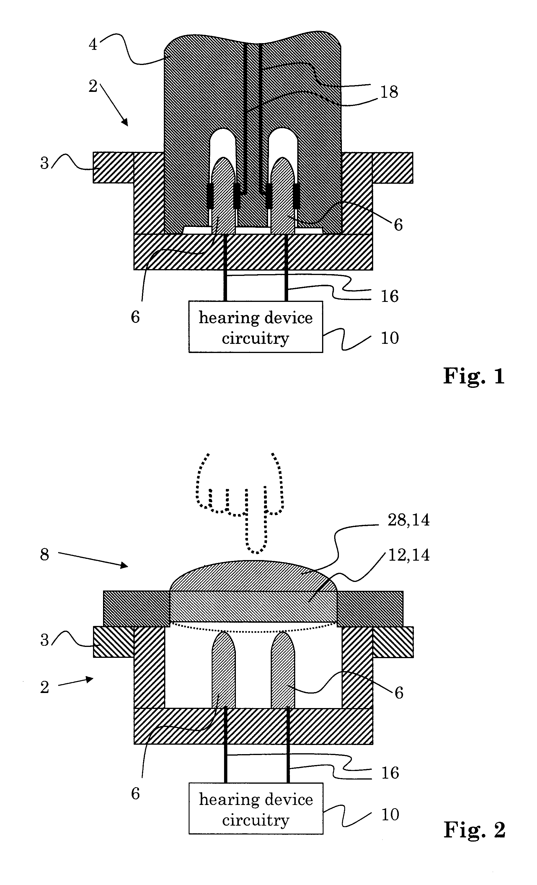 Hearing device with user control