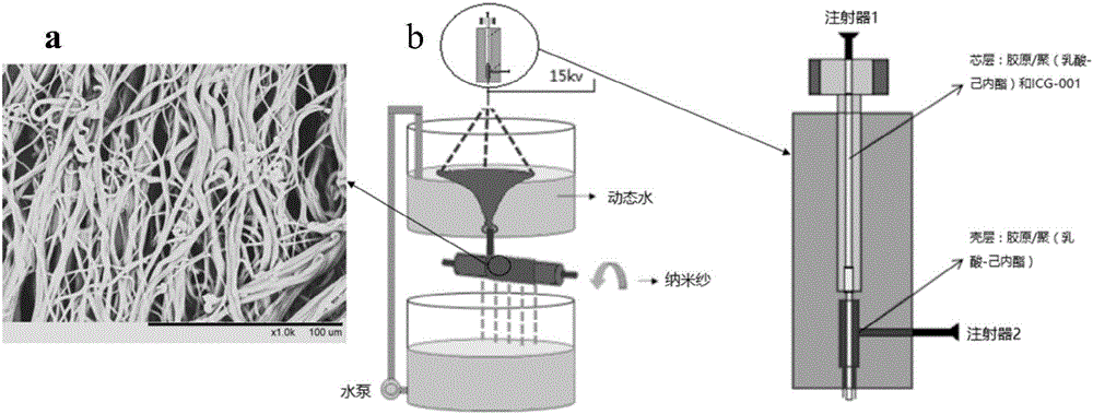 Biodegradable nano yarn capable of inhibiting fibrosis, and preparation and application thereof