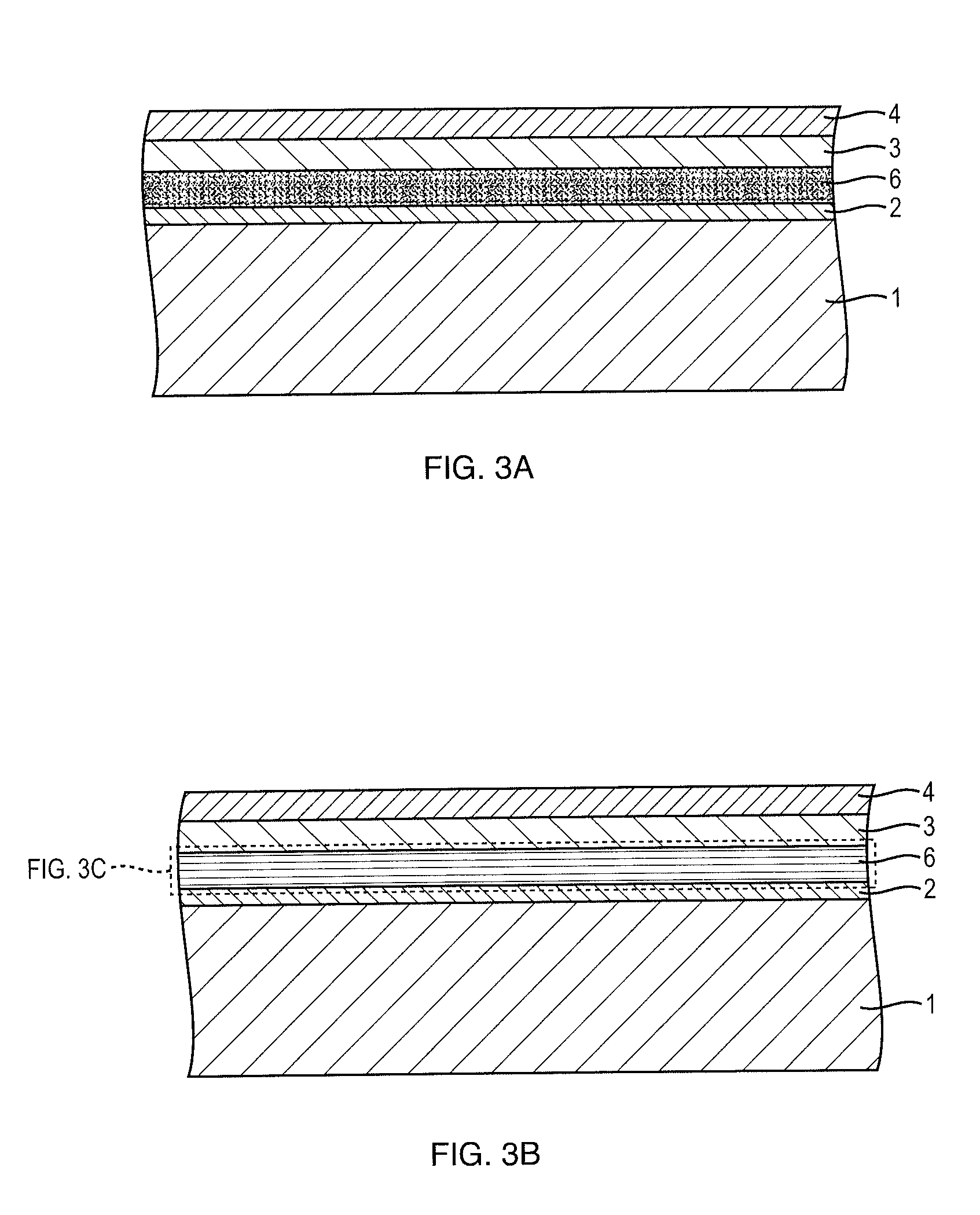 Surgical Implant