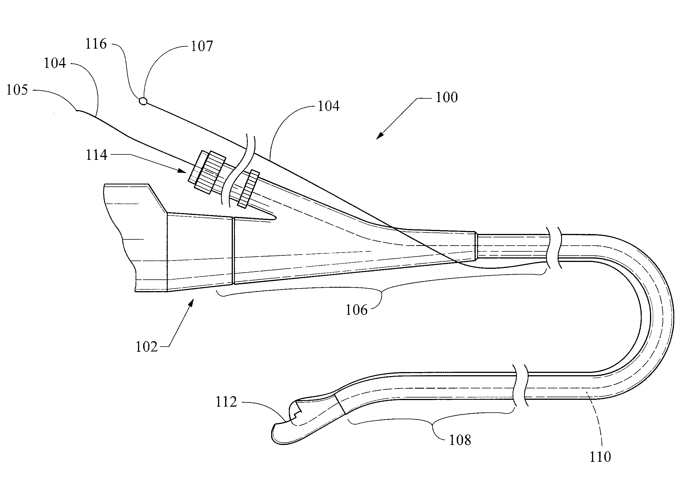 Advancing system and method of use thereof