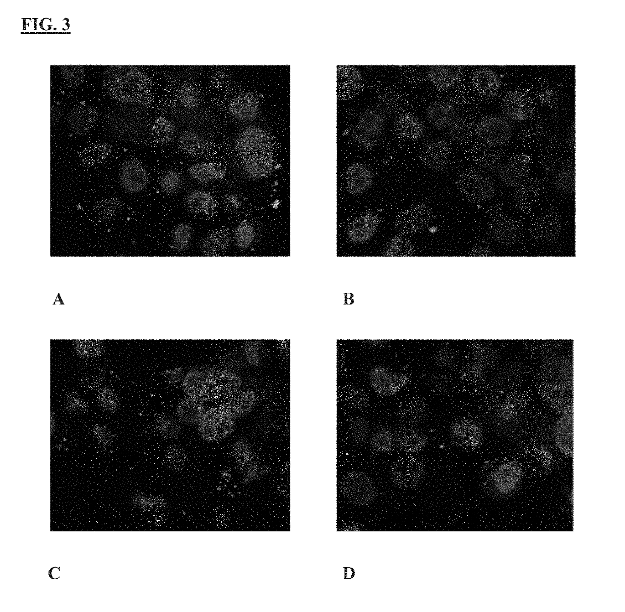 Vaccine for treatment or prevention of <i>Burkholderia </i>infection in a mammal