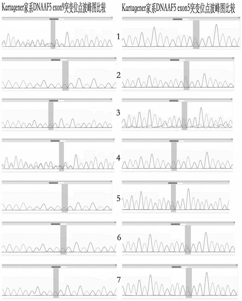 An autosomal recessive karagener syndrome mutant gene and its application