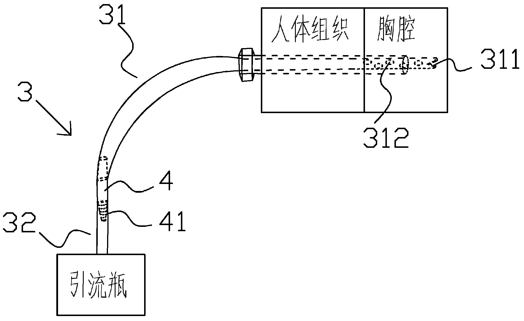 Pleural effusion drainage device