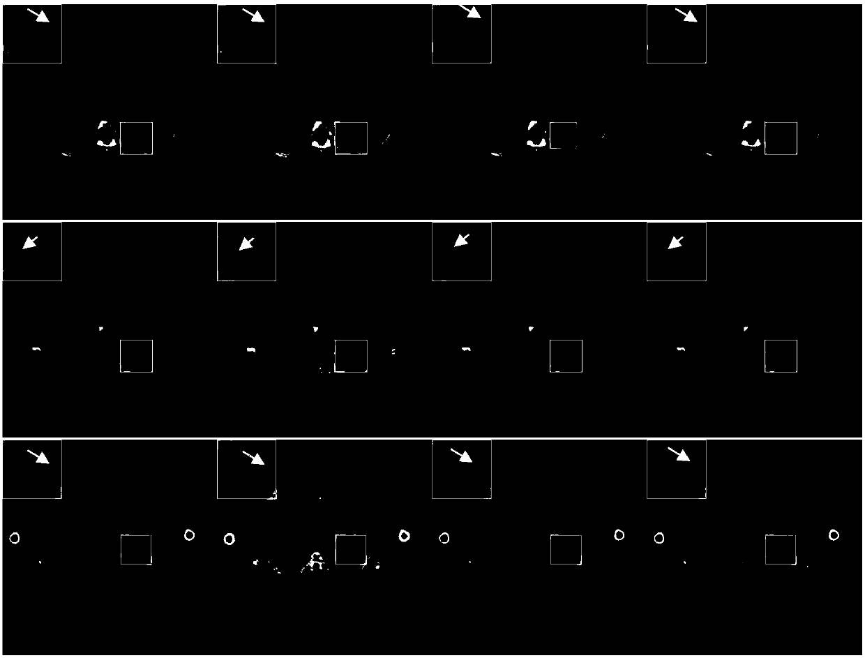 Residual error learning-based CT sparse reconstruction artifact correction method and system