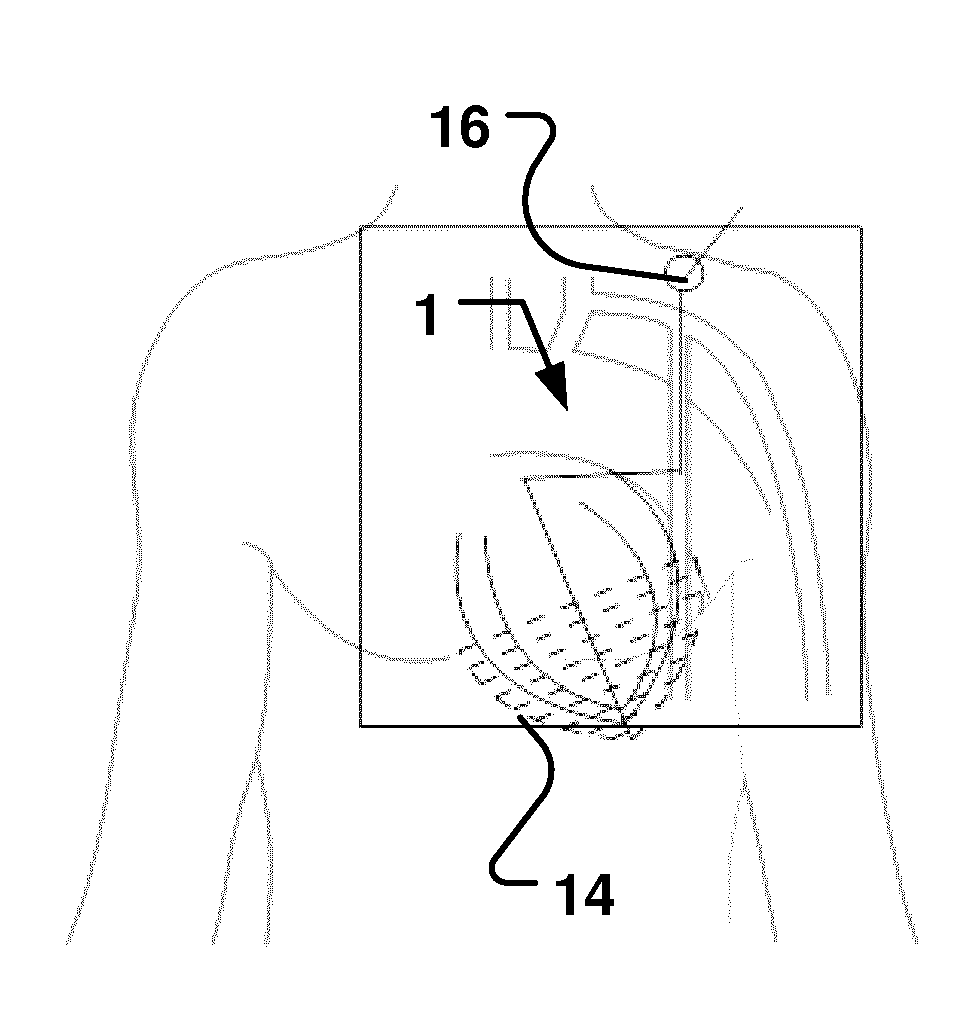 Device for performing diagnostics and/or therapy