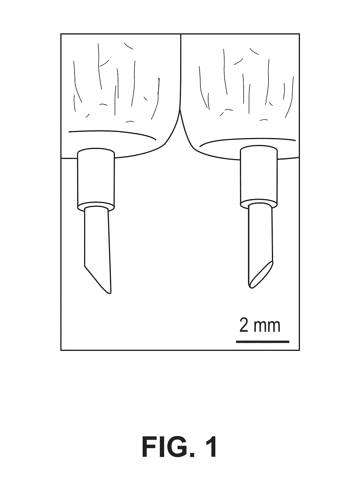 Nanoelectroablation control and vaccination