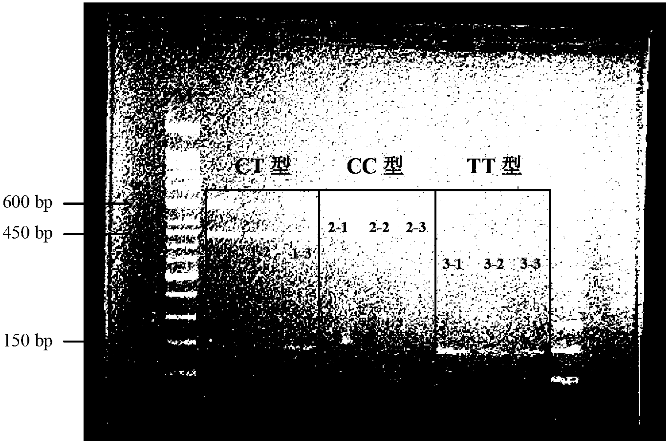 SNP (Single Nucleotide Polymorphism) marker related to human severe influenza in IFITM3-rs12252 gene and application thereof