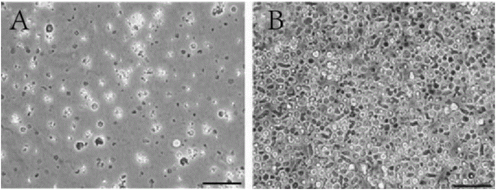 Extraction method and purpose of renewable particles of umbilical cord blood