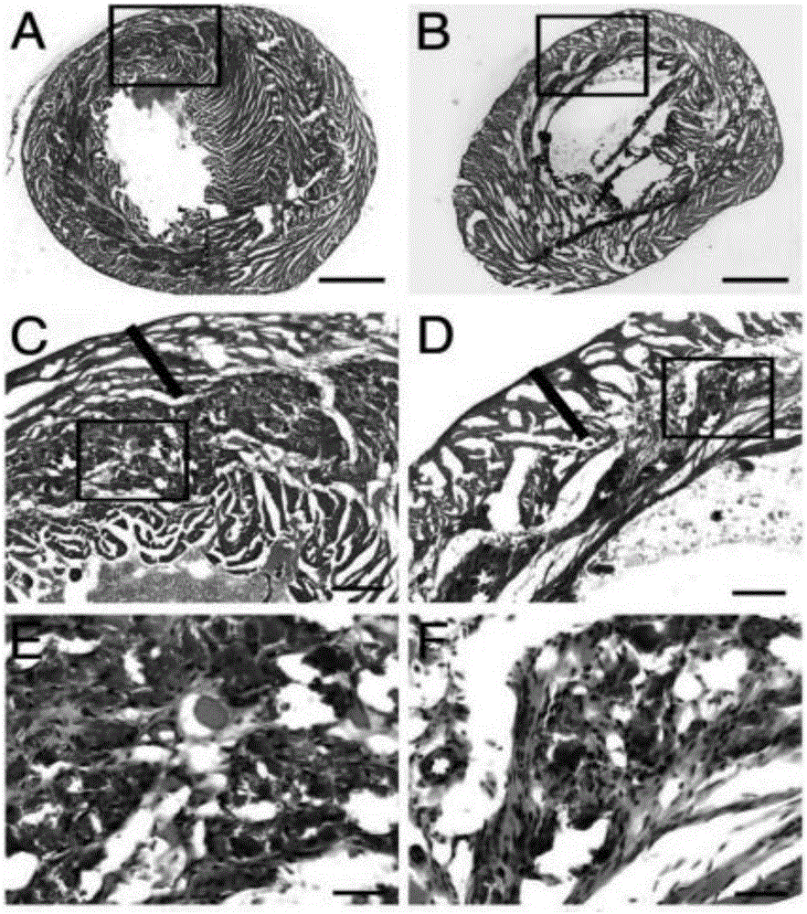 Extraction method and purpose of renewable particles of umbilical cord blood