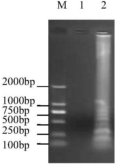 Odontoglossum ringspot virus RT-LAMP detection primer and detection method thereof