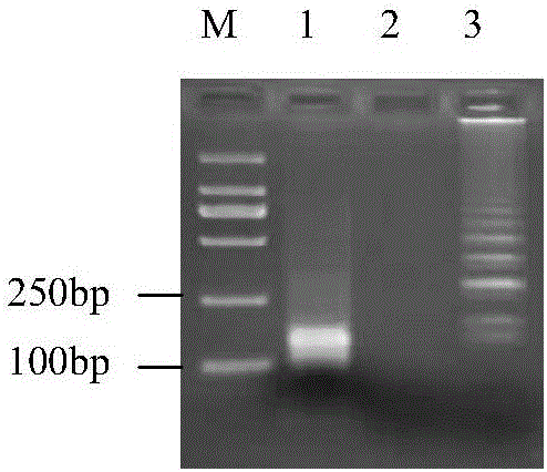 Odontoglossum ringspot virus RT-LAMP detection primer and detection method thereof