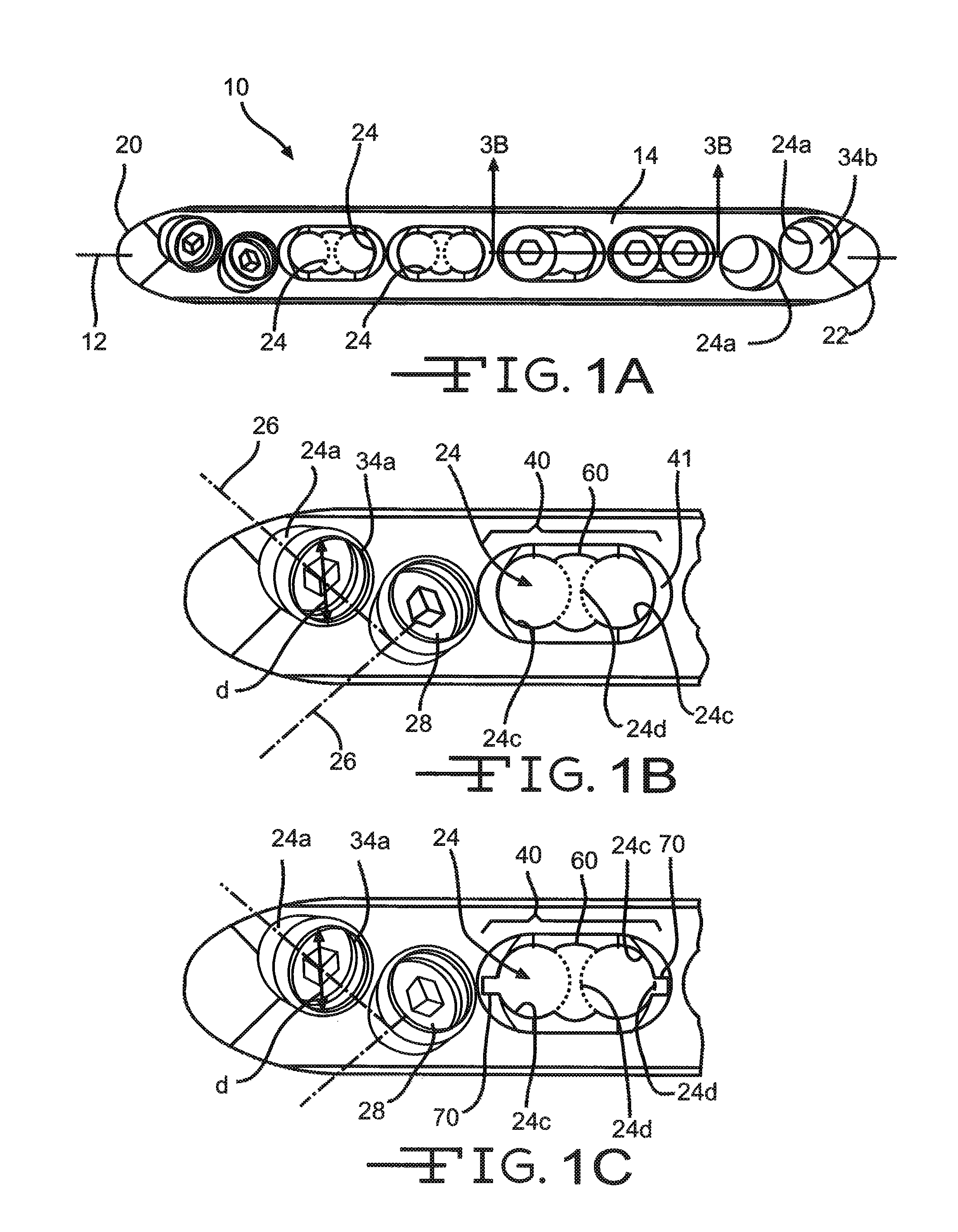 Bone plate with complex, adjacent holes joined by a bend relief zone