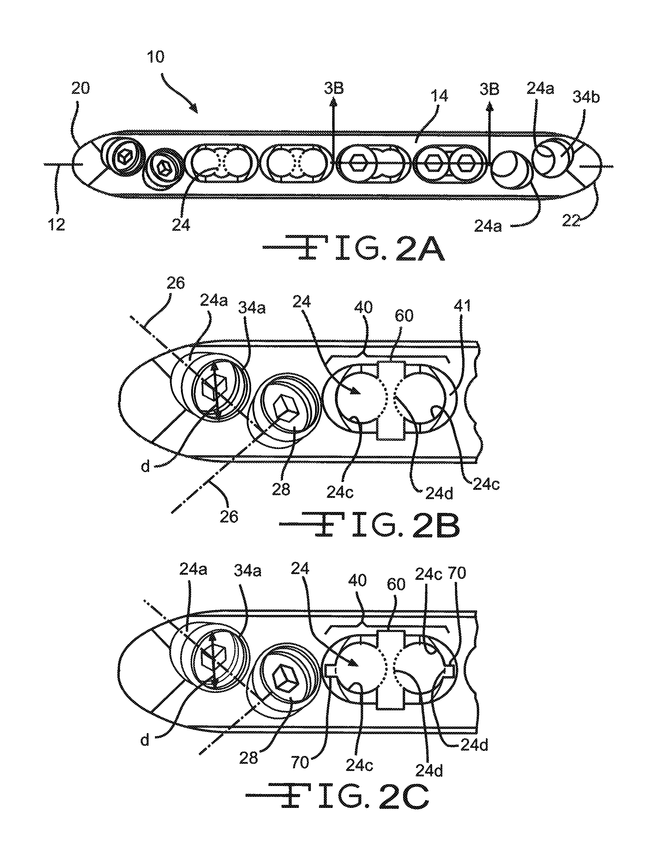 Bone plate with complex, adjacent holes joined by a bend relief zone