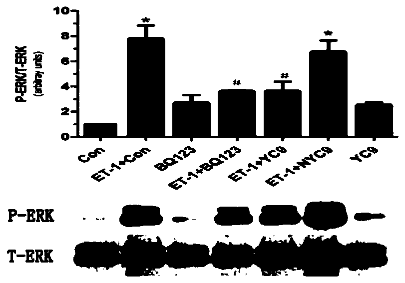 Human endothelin type a receptor immunogenic peptide and its carrier vaccine