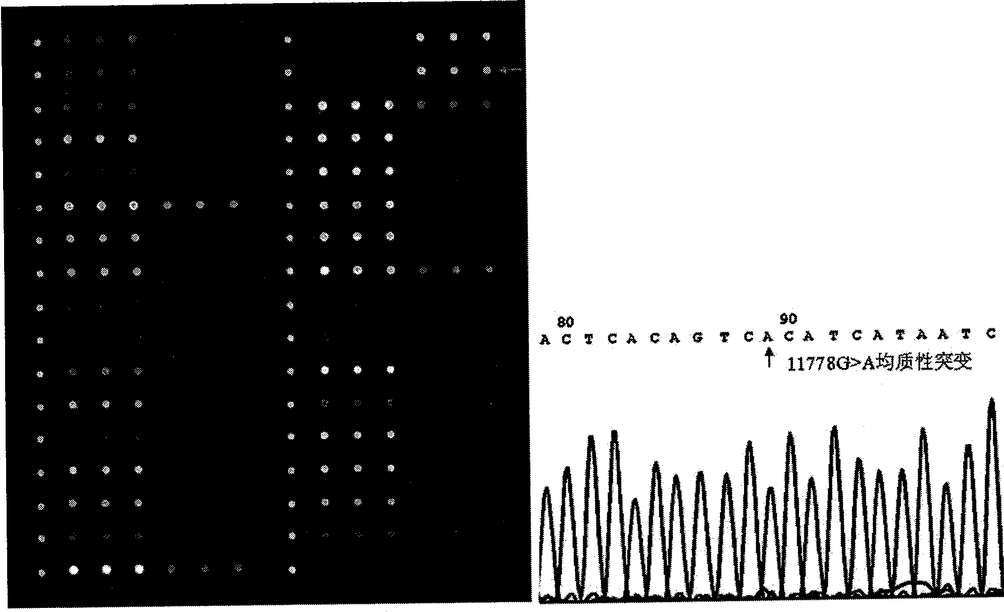 Leber's hereditary optic neuroretinopathy related mtDNA mutant site integrated detection gene chip, as well as preparation and use thereof