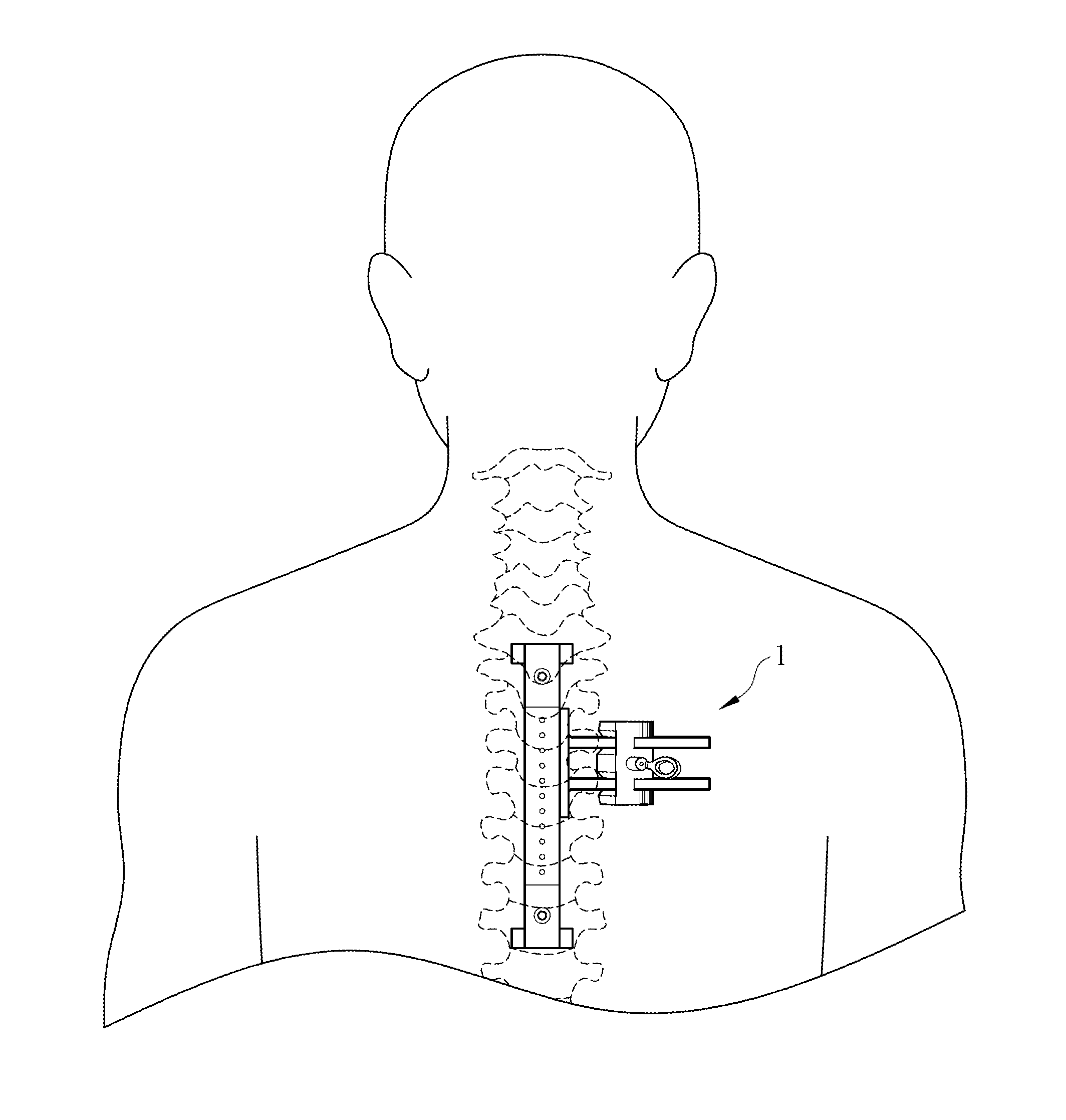 Assistant device and guiding assembly for percutaneous surgery