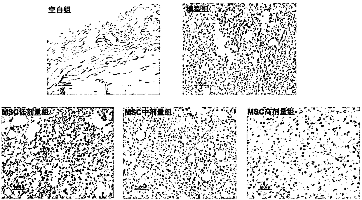 Human umbilical cord mesenchymal stem cell anti-rheumatic arthritis treatment method