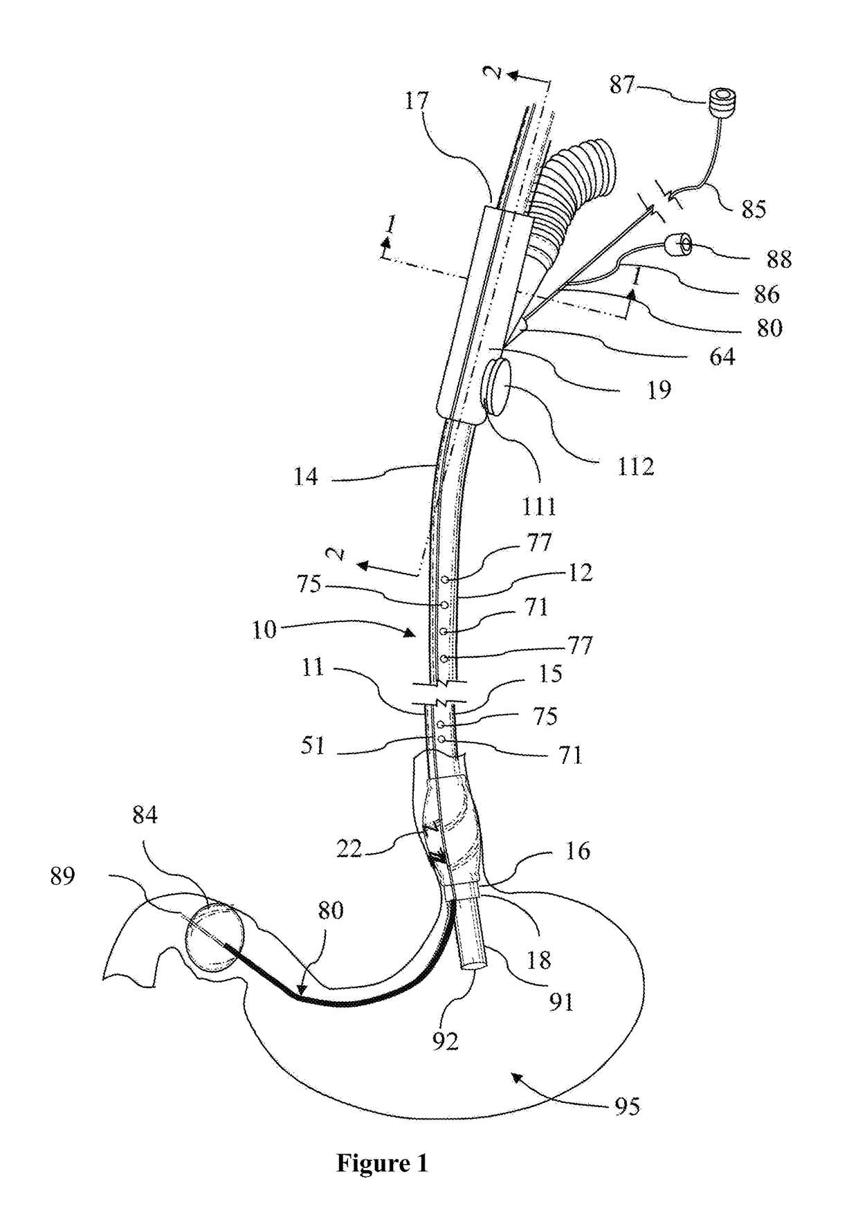 Endoscope Accessory