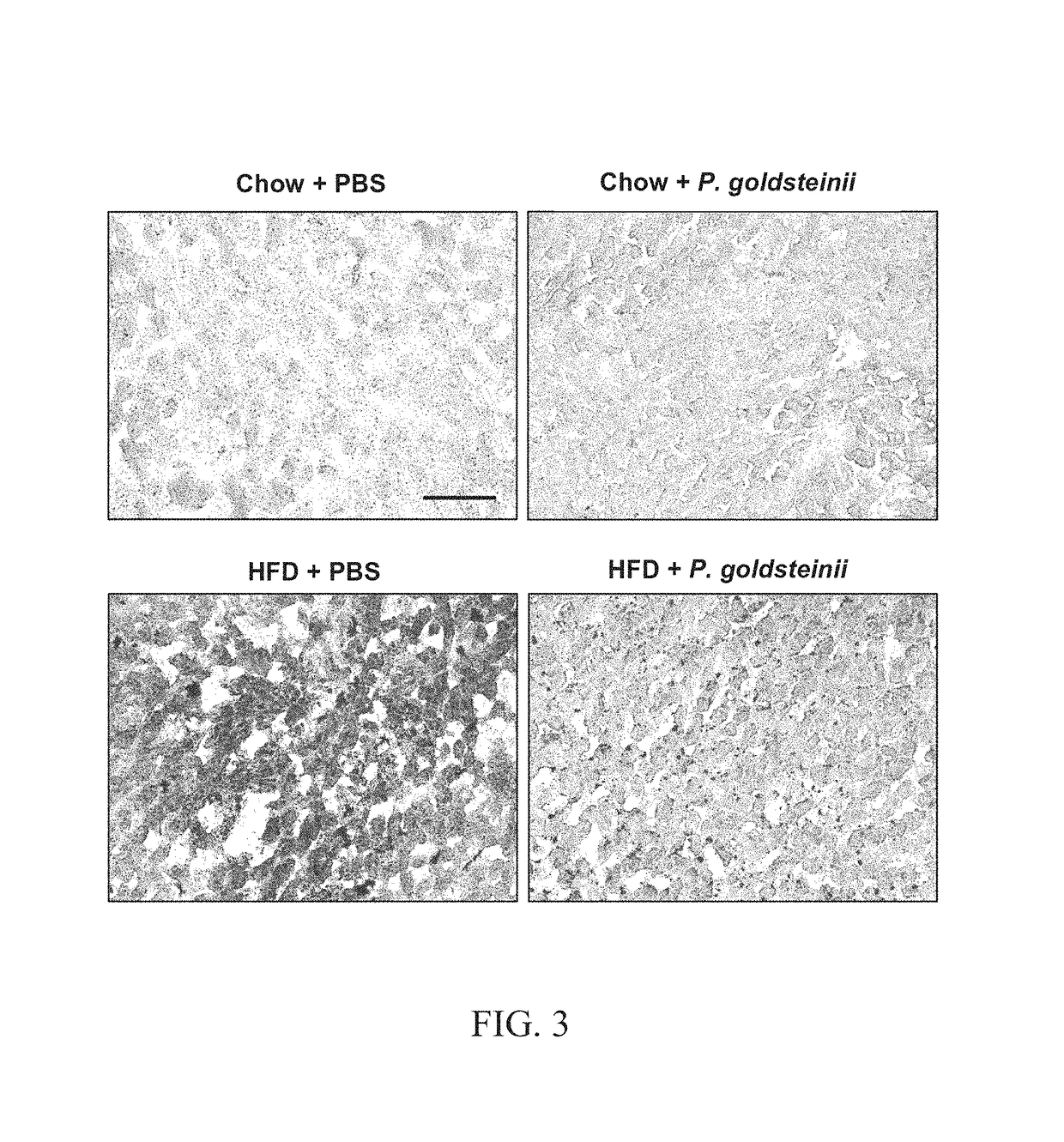 Method to treat fatty liver disease using <i>Parabacteroides goldsteinii</i>