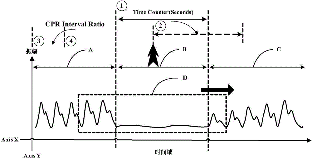 Method and equipment based on pulse blood oxygen technology to monitor cardio-pulmonary resuscitation) pressing interruption time