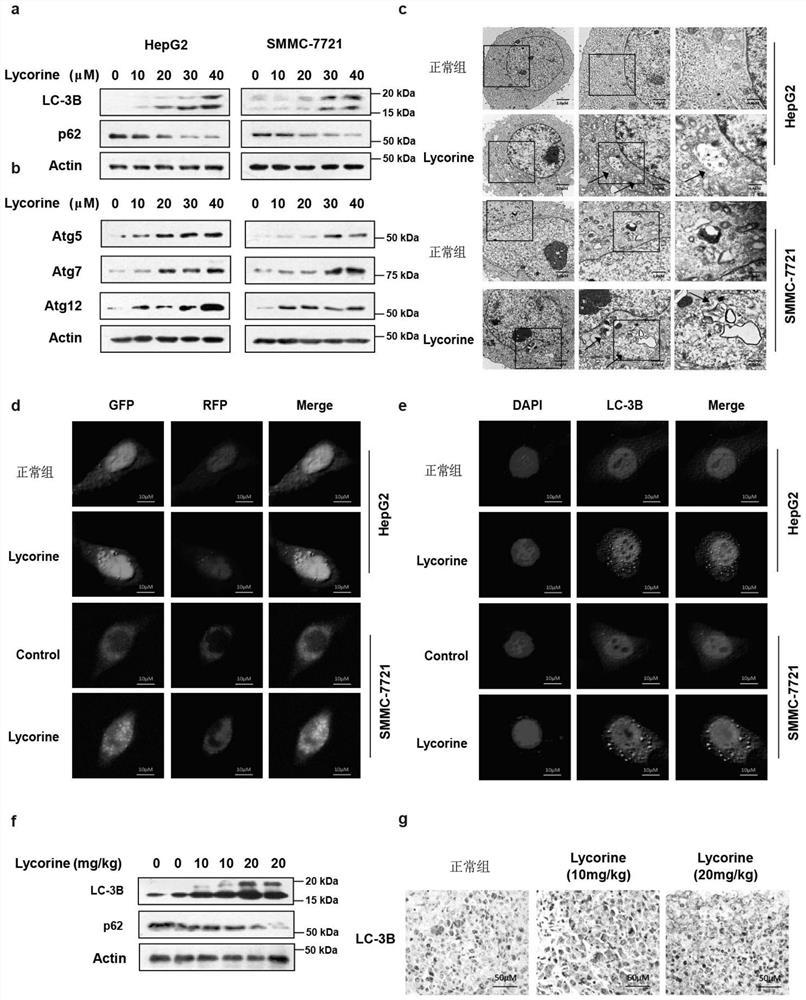 Application of autophagy inhibitors in the preparation of drugs that enhance the anti-liver cancer activity of lycorine