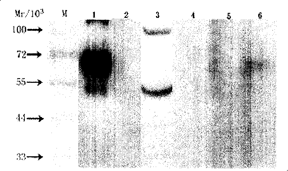 CYP4A11 polypeptide