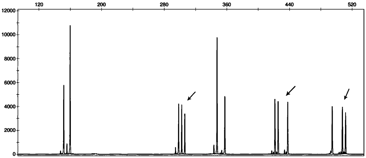 Primer set and detection kit for detecting STR gene locus of human chromosome 4 and application of primer set