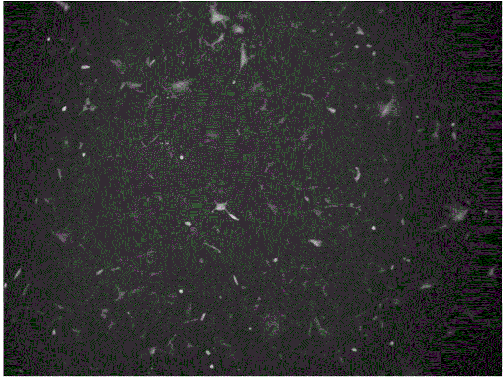 siRNA for inhibiting expression of FABP4 gene and application of sirna