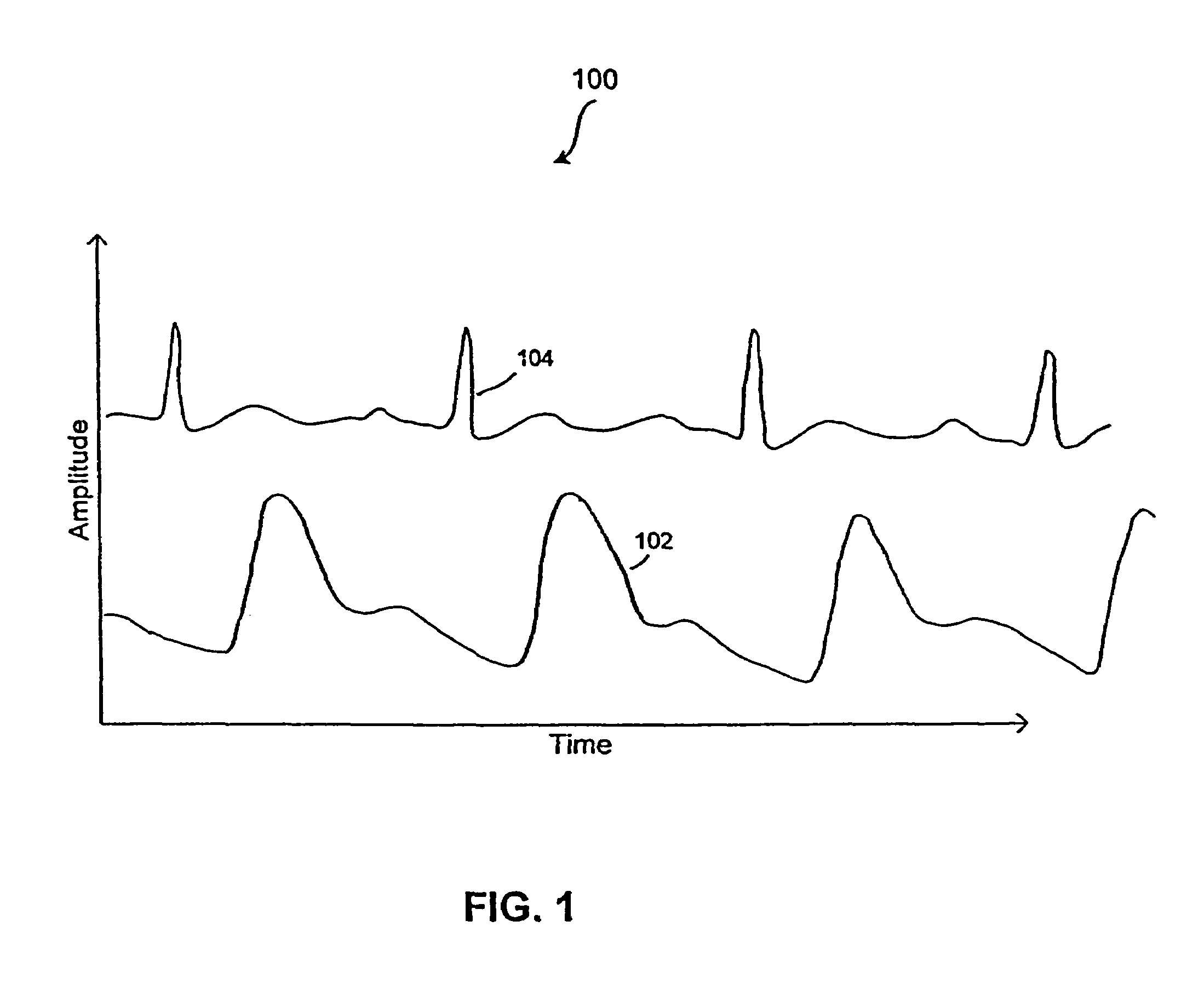 Methods and devices for reduction of motion-induced noise in pulse oximetry