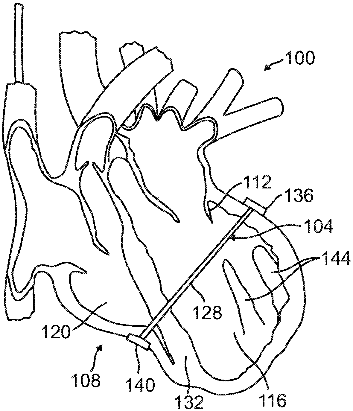 Systems and devices for setting anchor