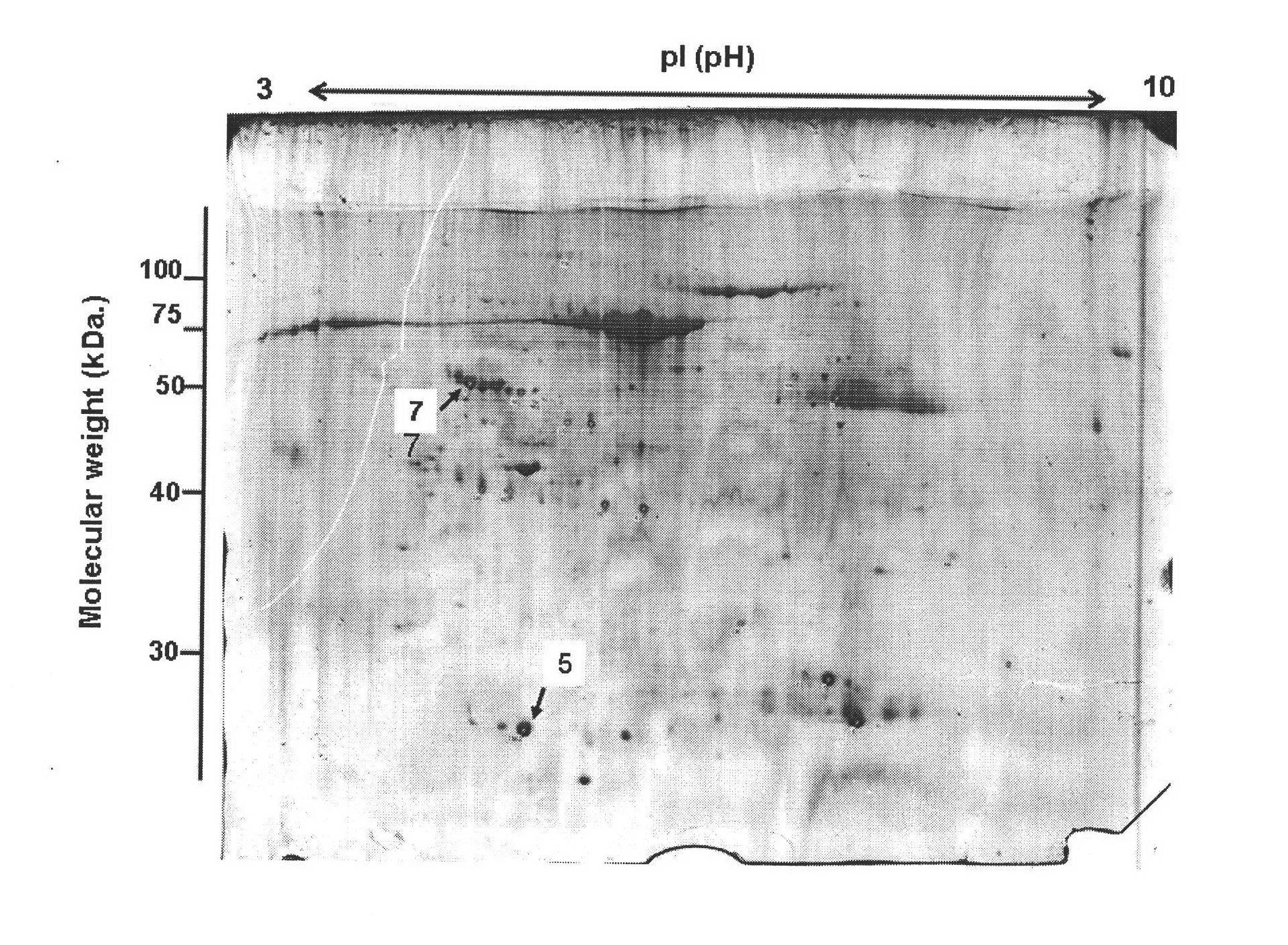 Application of methazolamide in preparing medicament for treating ankylosing spondylitis