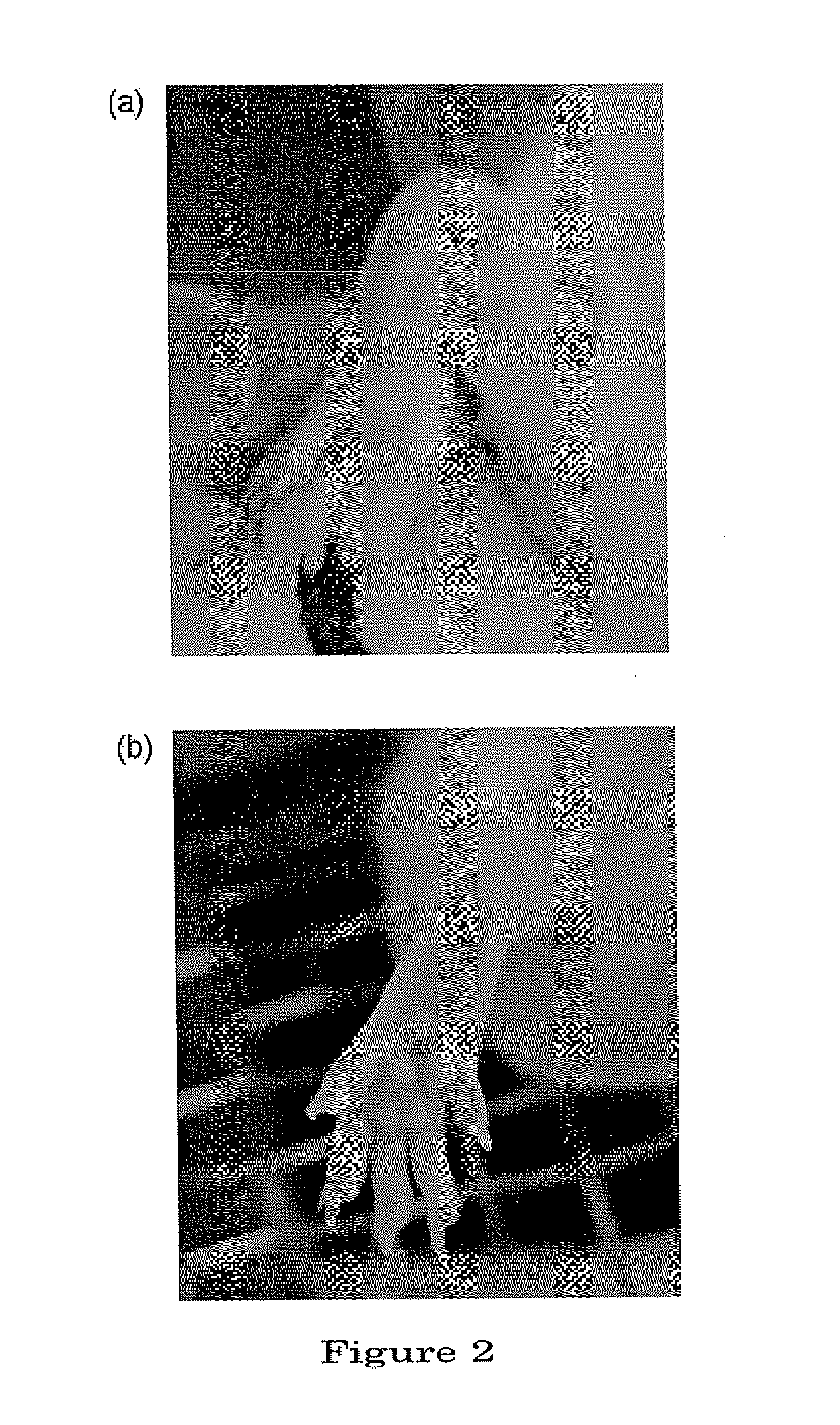 Therapeutic and prophylactic agents for arthritis