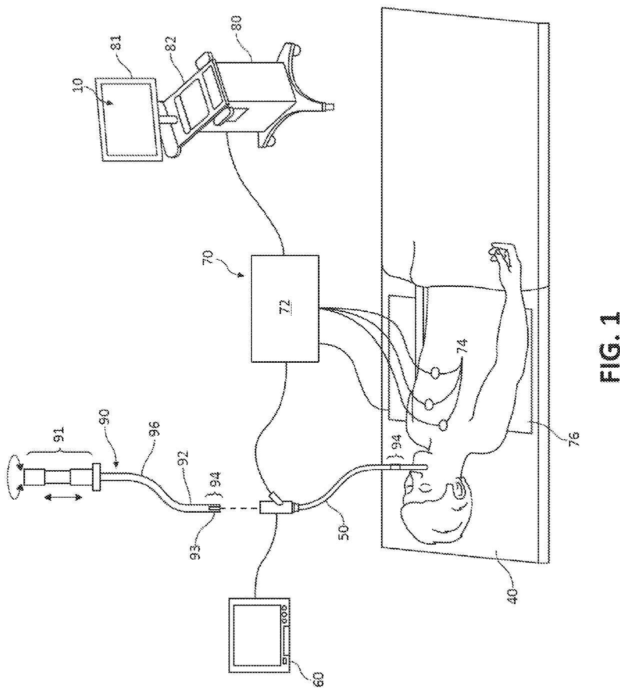 Systems and methods for navigational bronchoscopy and selective drug delivery