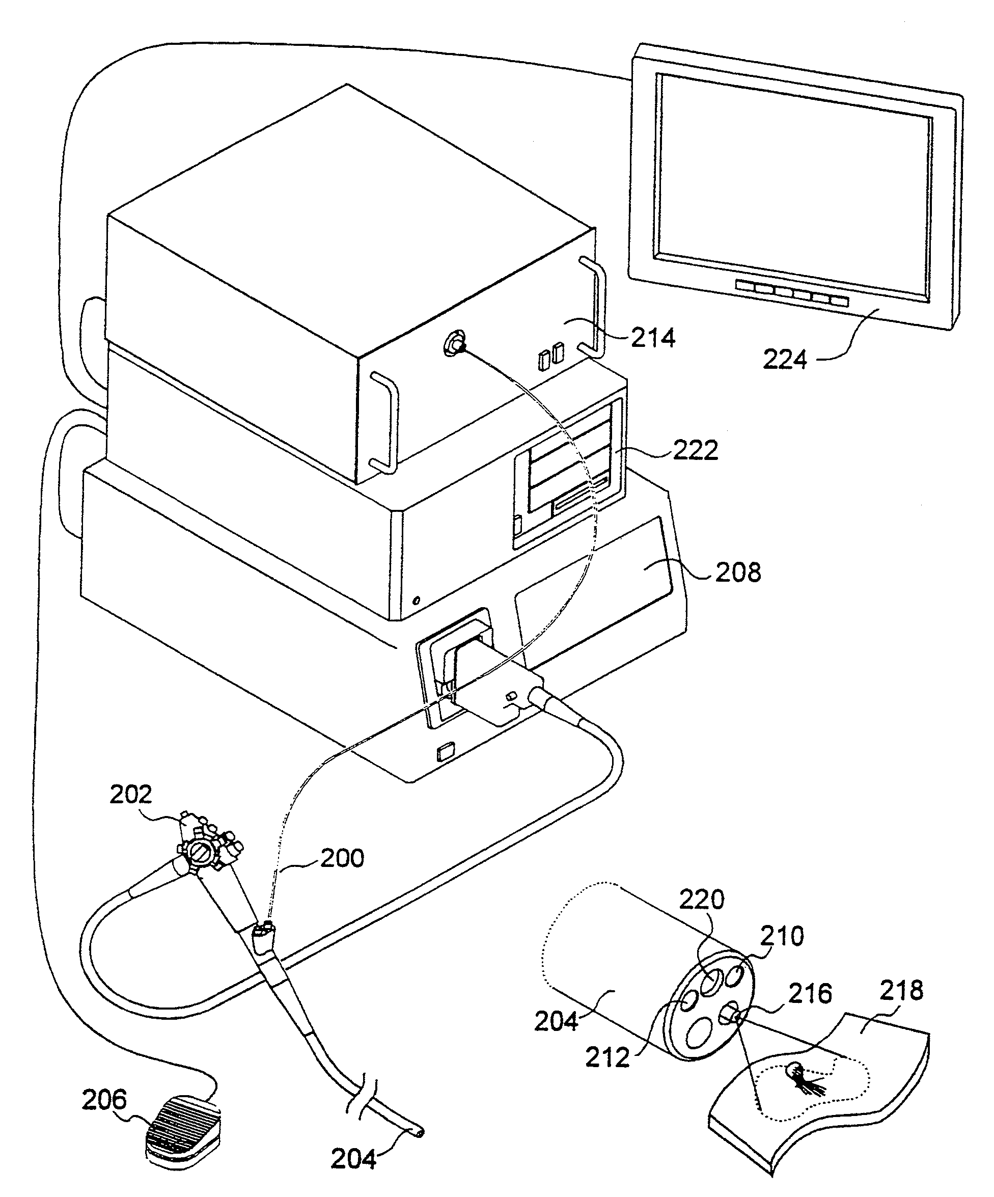 Autofluorescence imaging system for endoscopy