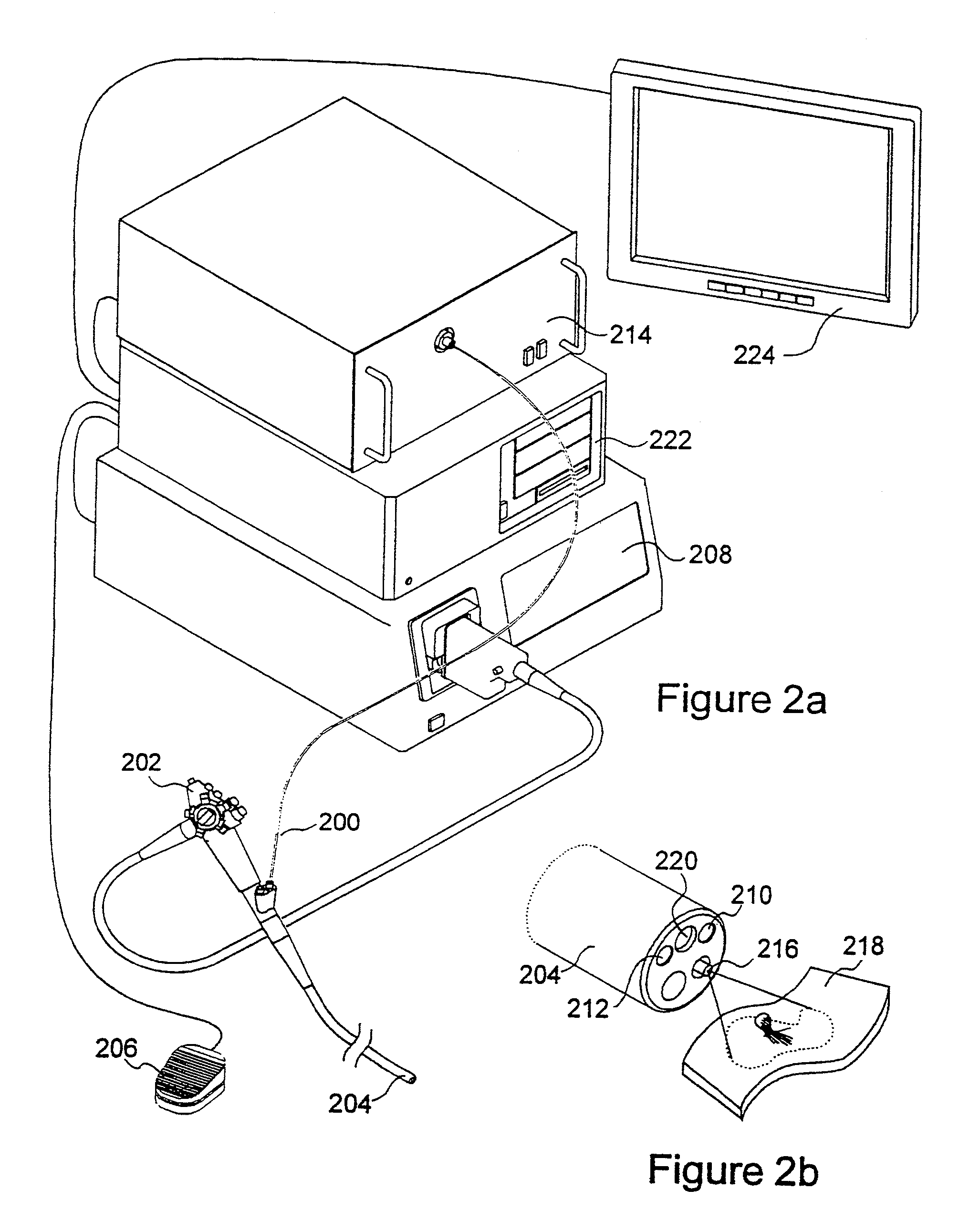 Autofluorescence imaging system for endoscopy