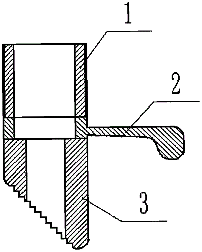 Femoral myelocavity file entryway protective sleeve provided with handheld device