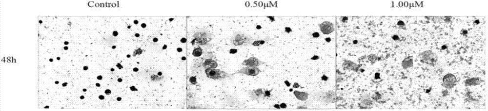 Application of LukS-PV protein in preparation of medicine for inducing leukemia cell differentiation