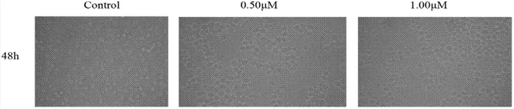 Application of LukS-PV protein in preparation of medicine for inducing leukemia cell differentiation