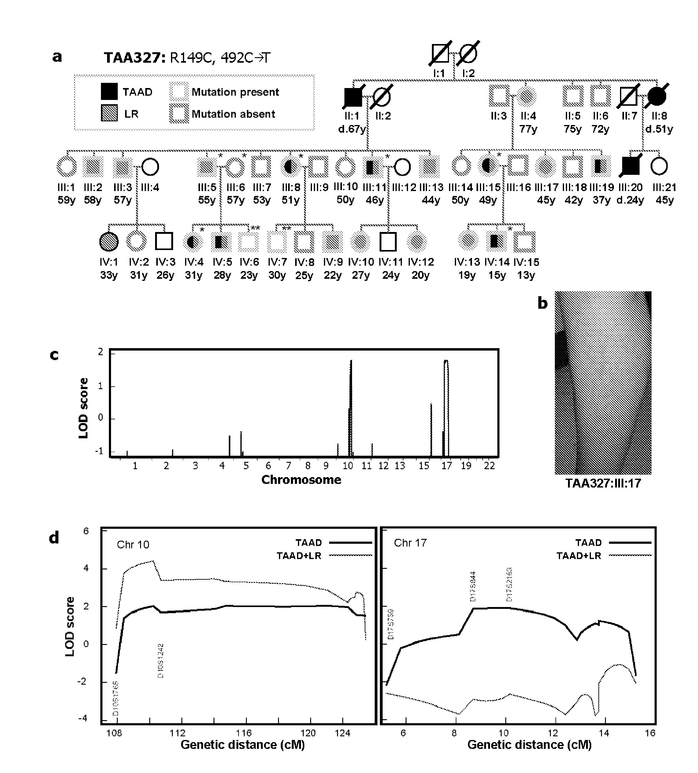 Detection of mutations in acta2 and myh11 for assessing risk of vascular disease