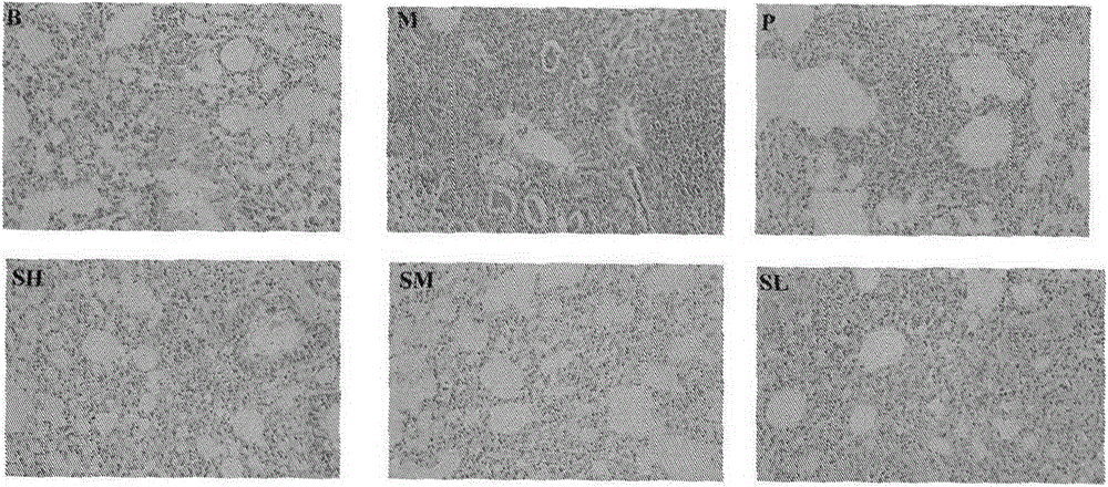 Application of norwerethrin-7-sulfate in the preparation of anti-pulmonary fibrosis drugs