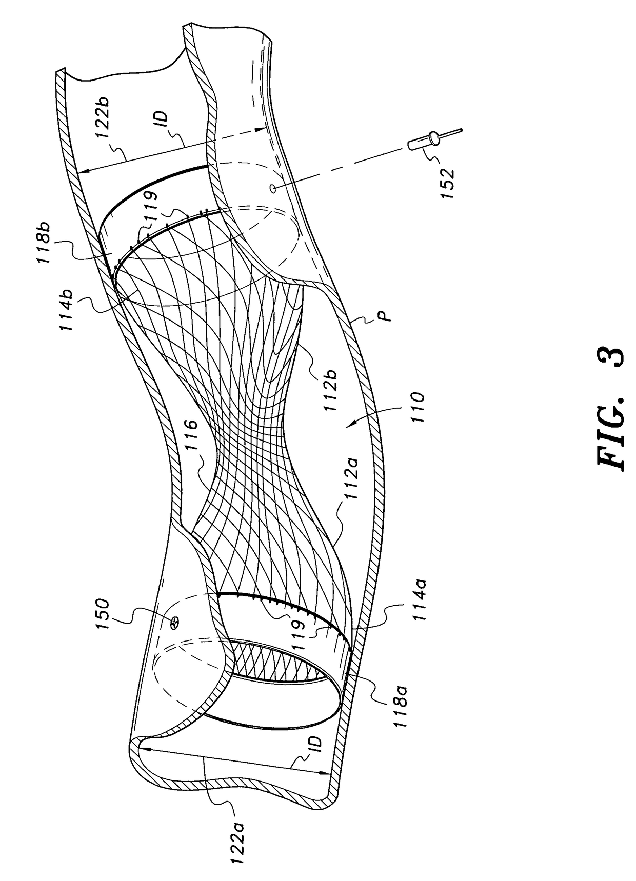 Inserts for engine exhaust systems