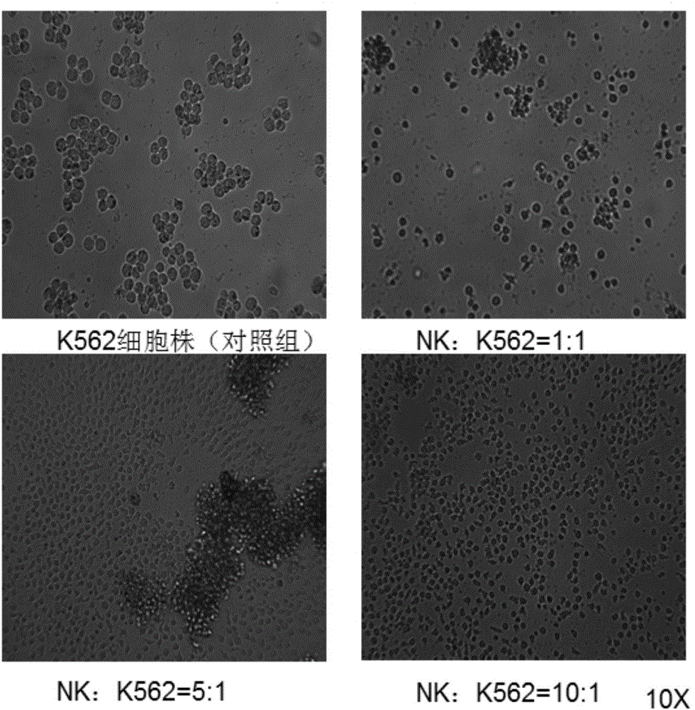 In-vitro large-scale amplification method of natural killer cells