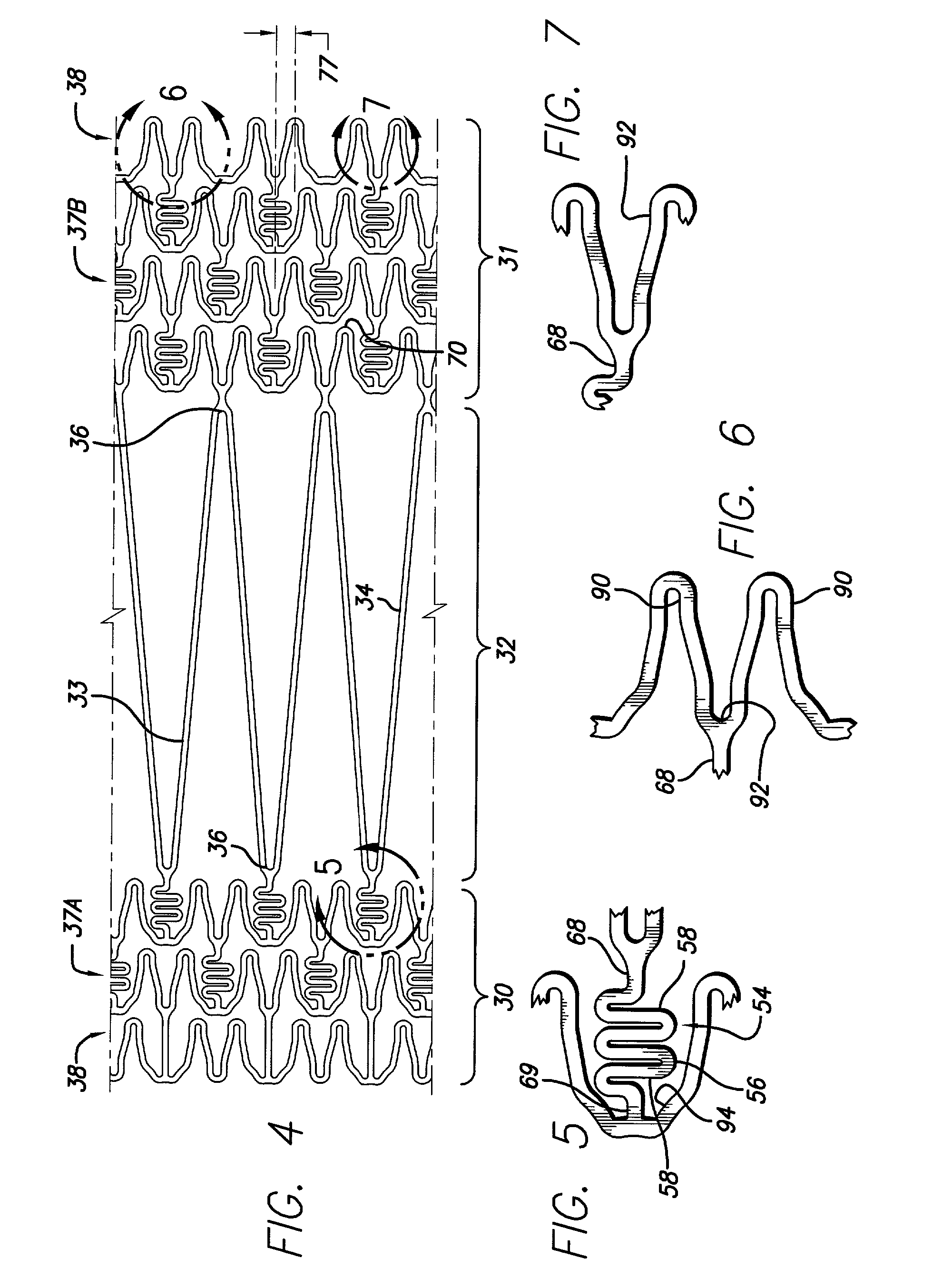 Intravascular stent and method of use