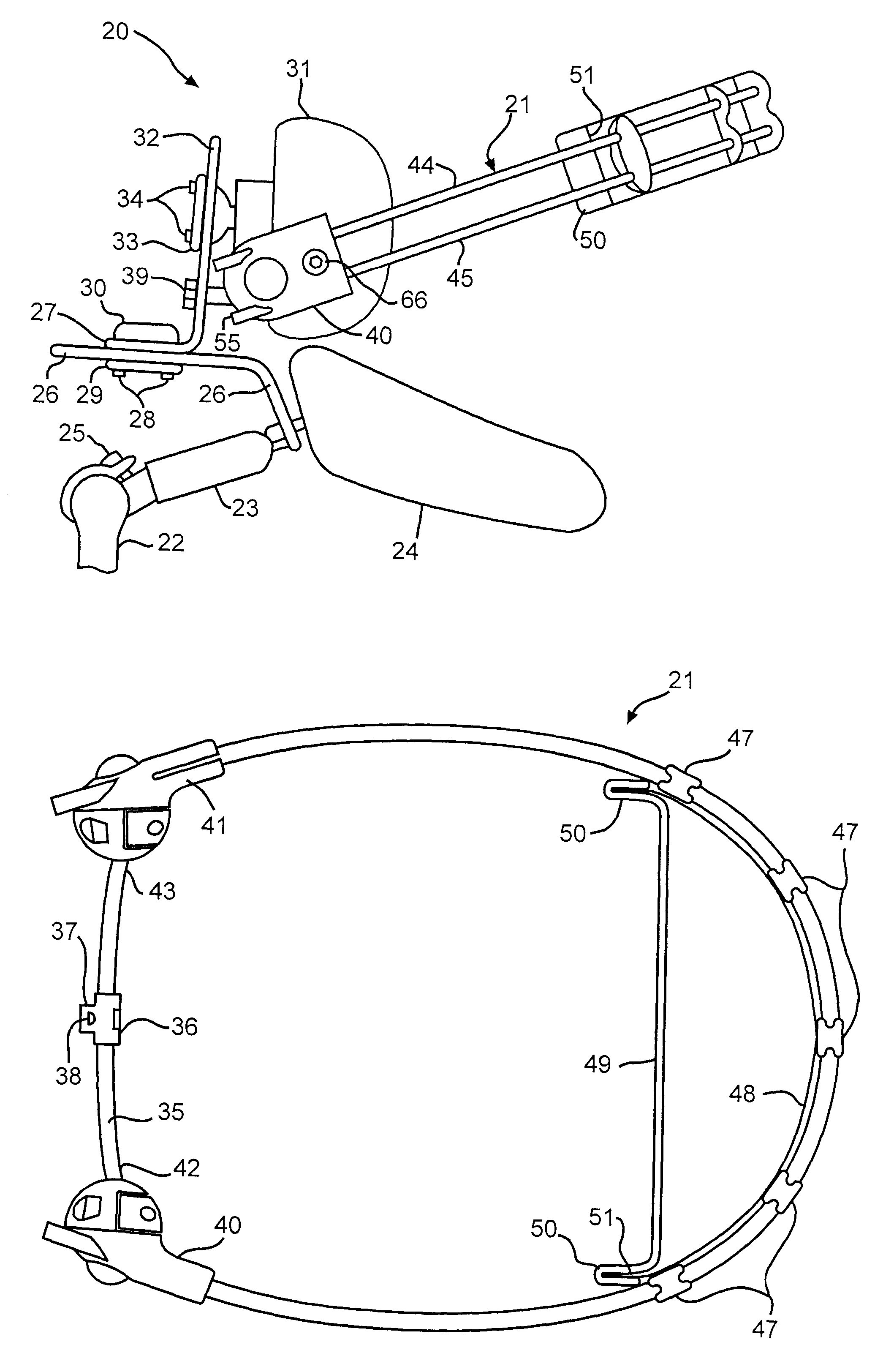 Semi-rigid anterior head alignment system