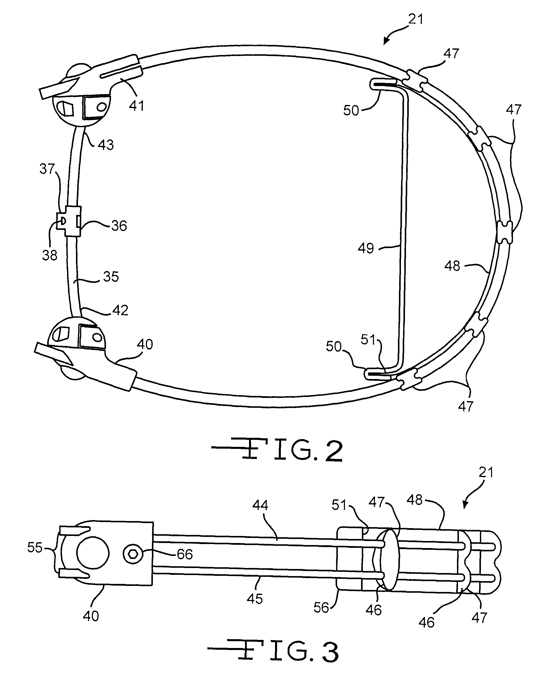 Semi-rigid anterior head alignment system