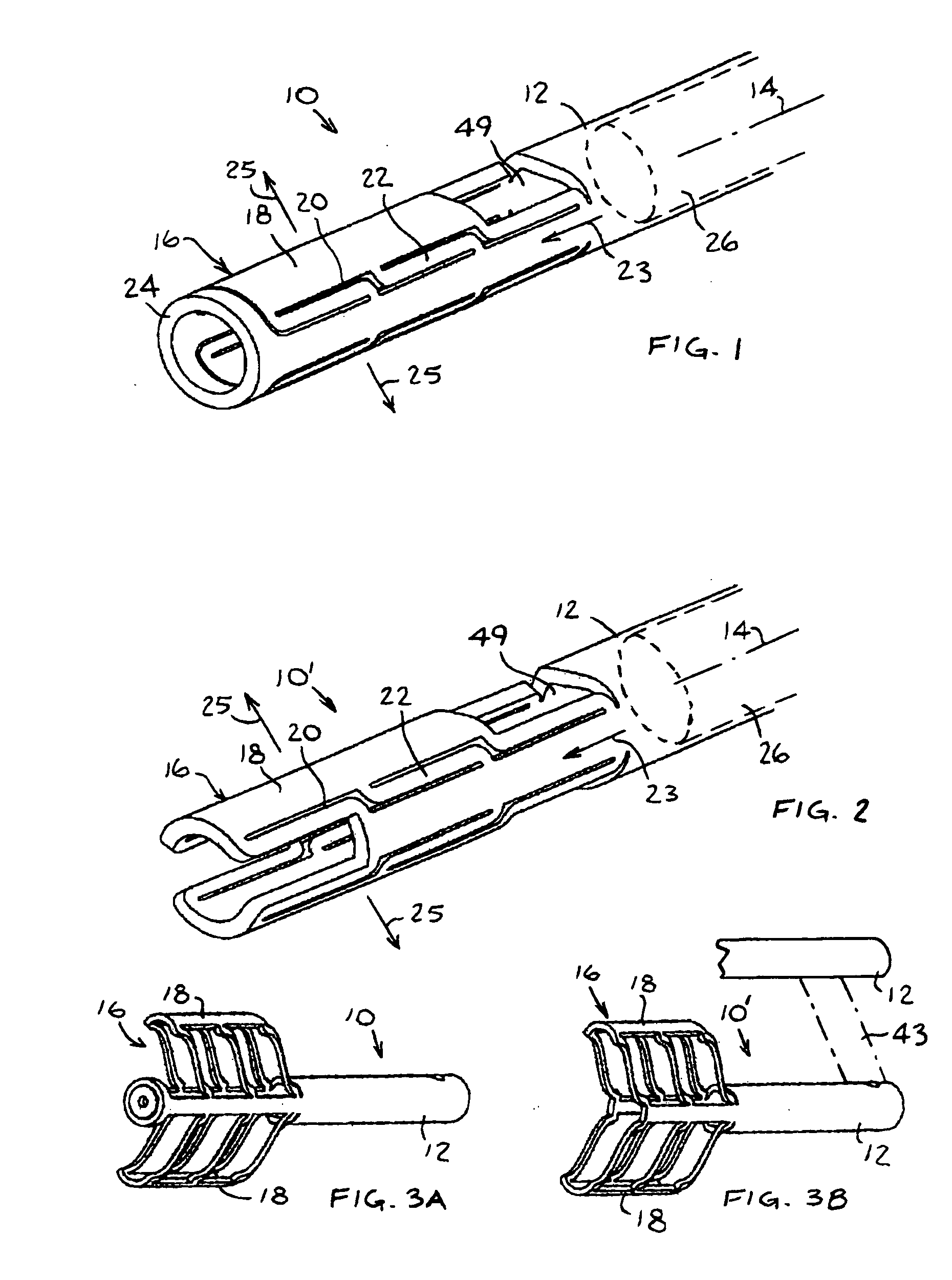 Expandable bone device