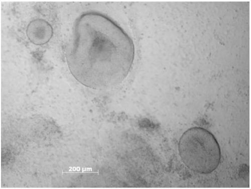 Simple, highly-efficient and mechanized inducing method for differentiation of human pluripotent stem cells into retinal tissues